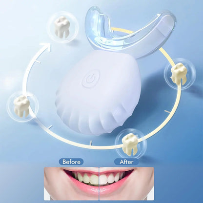 SmartSmile Teeth Whitening Kit