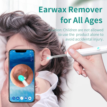 Smart Visual Ear Wax Remover